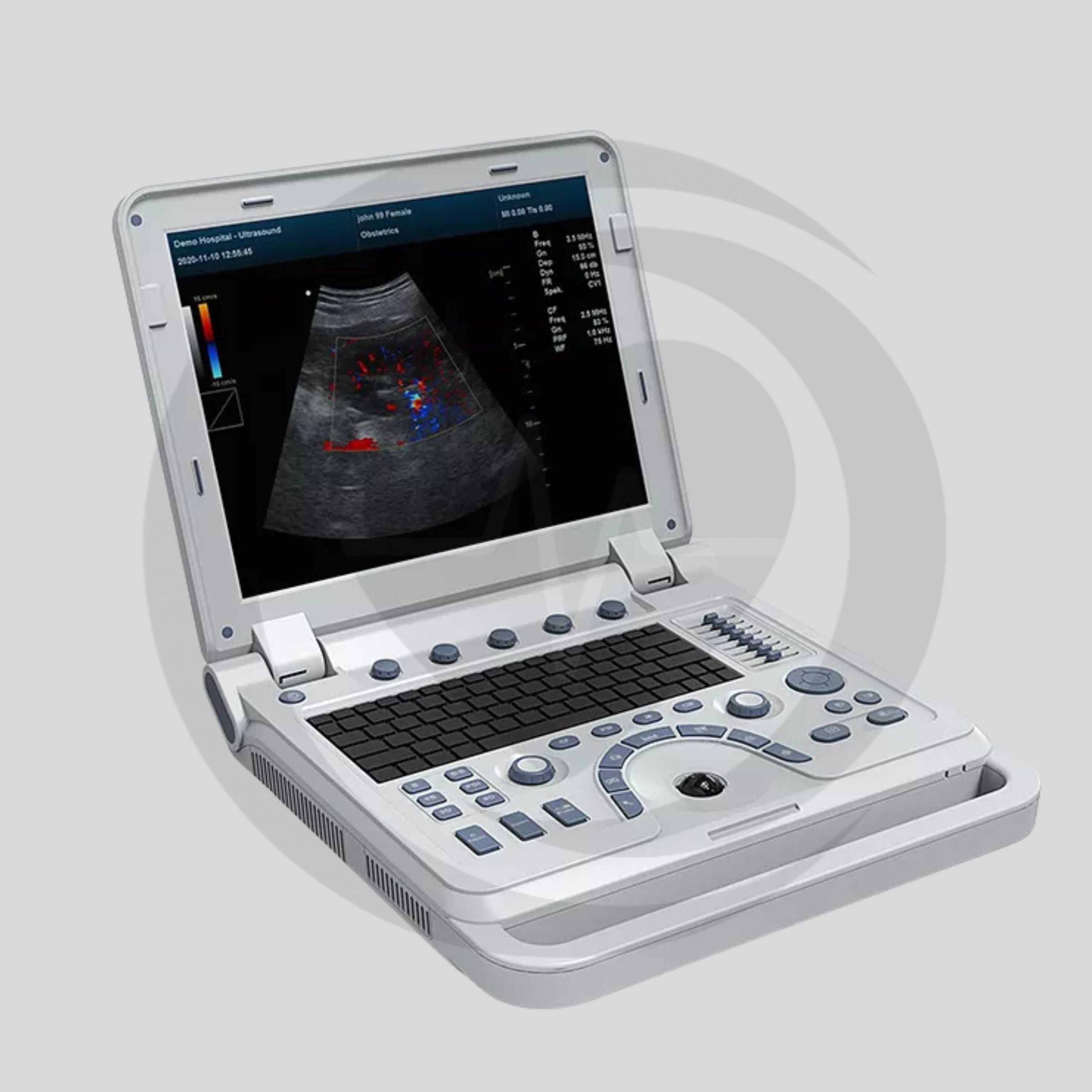Ecógrafo Colorido Doppler CONTEC CMS1700A (Convexa)
