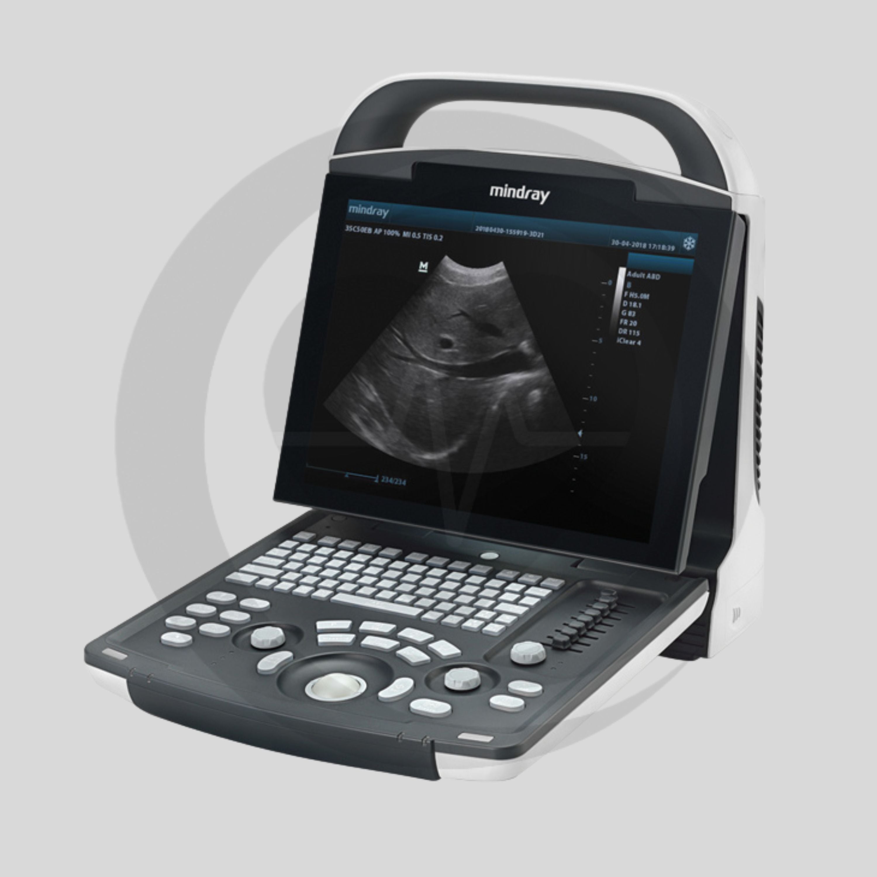 Ecógrafo Mindray DP-10 (Convexa)