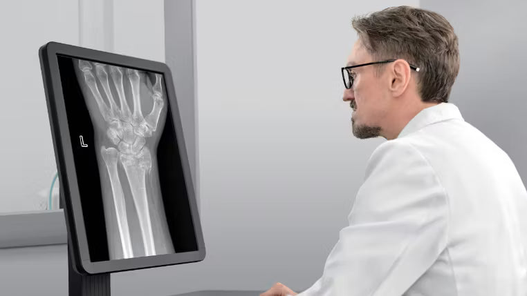 Sistema de Raio-X Digital com Detector Integrado Mindray DigiEye 330