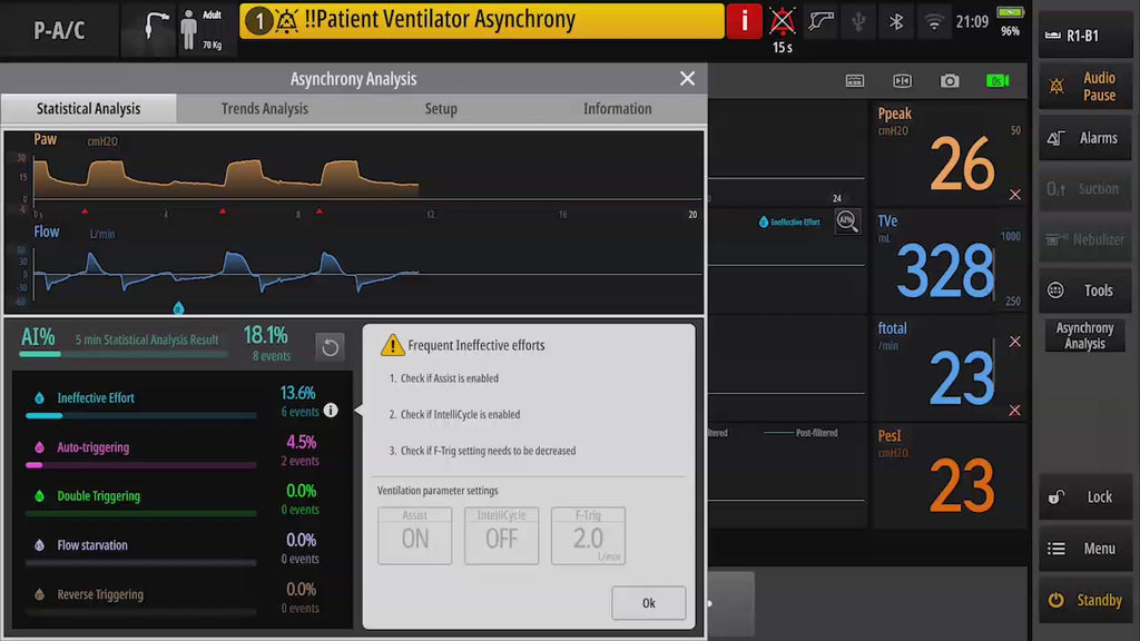 Ventilador de Terapia Intensiva Mindray SV900 / SV700