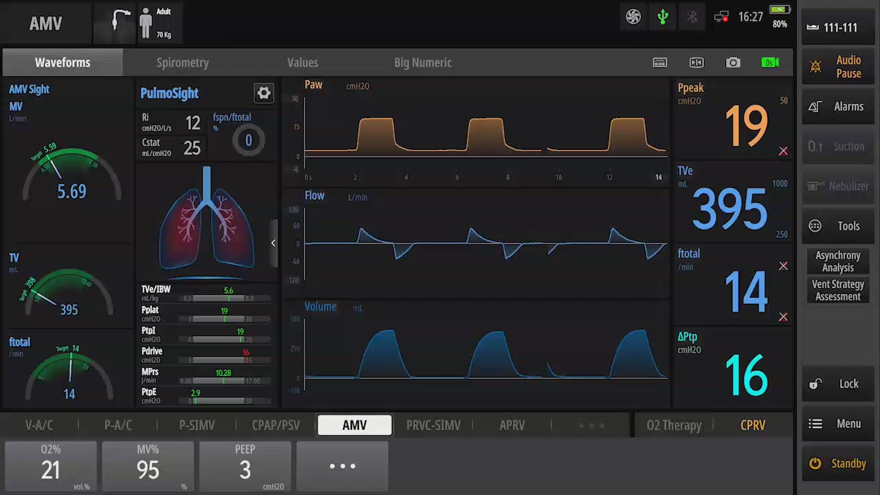 Ventilador de Terapia Intensiva Mindray SV900 / SV700