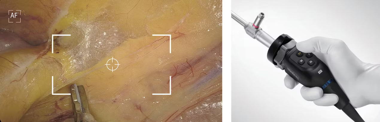 Endoscópio 4K Mindray UX1