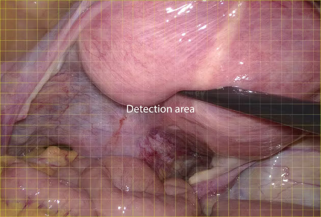 Endoscópio 4K Mindray UX1