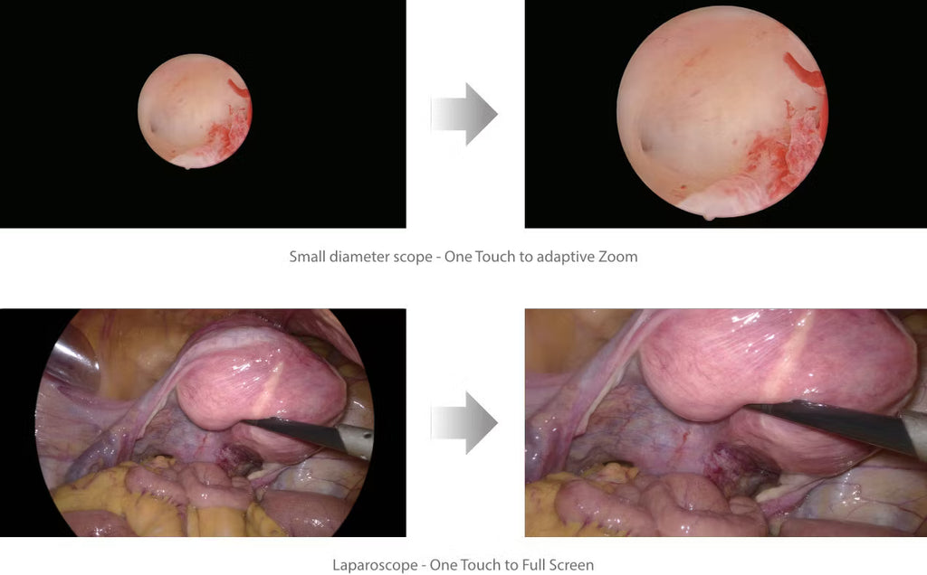 Endoscópio 4K Mindray UX1